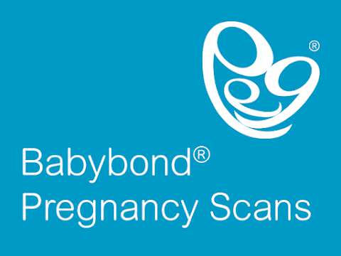 Ultrasound Direct Peterborough - Babybond photo